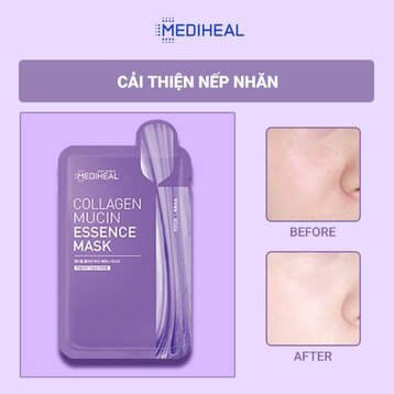Mặt Nạ Mediheal Giảm Nếp Nhăn, Ngăn Ngừa Lão Hoá 20ml