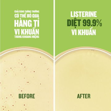 Nước Súc Miệng Listerine Trà Xanh Ngừa Sâu Răng 100ml